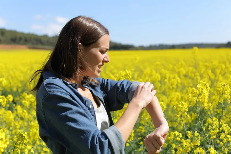 Insect bites and insect venom allergy