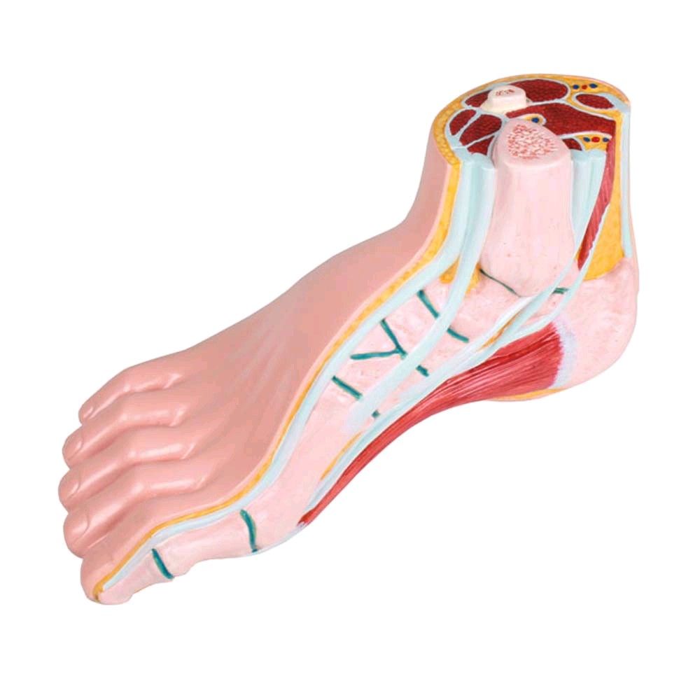 Erler Zimmer pes cavus model, open media, life-size, right foot