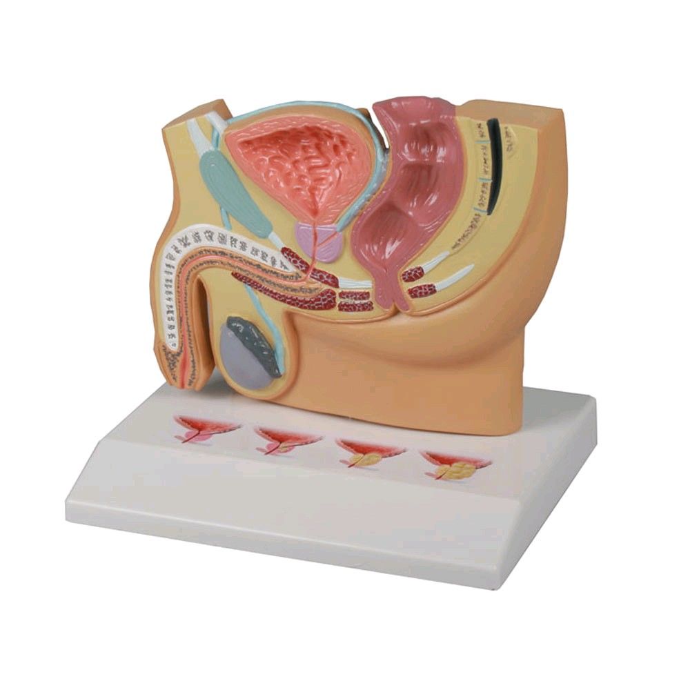 Erler Zimmer Pelvis Section Model, prostate diseases, 1/2 size