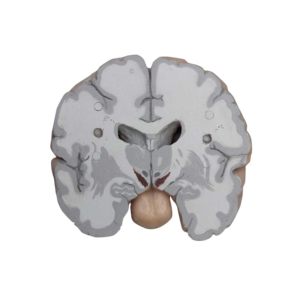 Erler Zimmer Model - Human Brain Multiple Frontal Sections