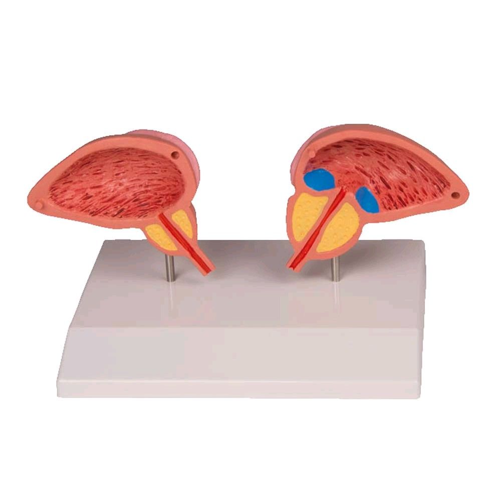 anatomical model of prostate by Erler Zimmer, 2-piece, 3/4 Size