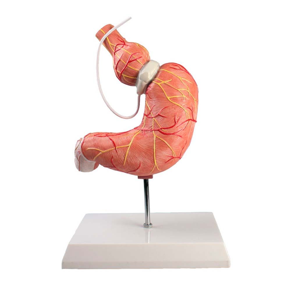 Erler Zimmer Model - Stomach with Gastric Band, on Stand