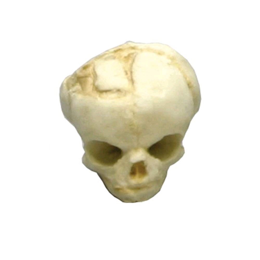 Erler Zimmer fetus skull anatomy model, 17. Development Weeks