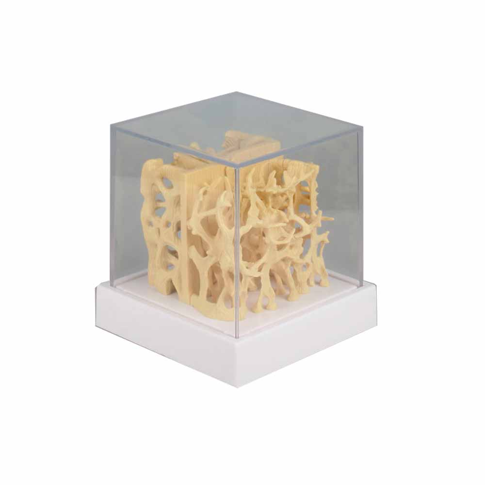 Erler Zimmer Comparision Model - Healthy/Osteoporotic Bone Structure