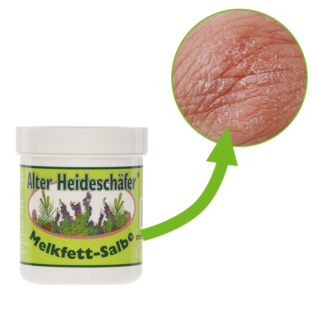 Asam Alter Heideschäfer® Milking Fat Ointment, Skin Protection, 100ml