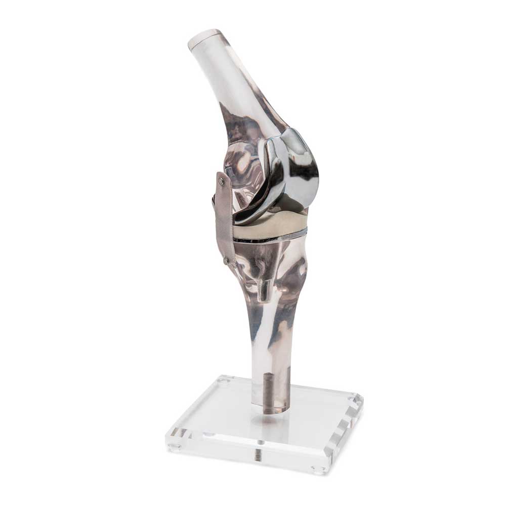 Erler Zimmer Knee Model with Endoprosthesis, Life Size