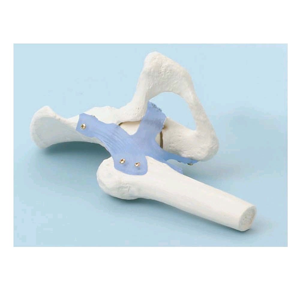 Erler Zimmer Hip joint + ligaments model, mobile, with stand