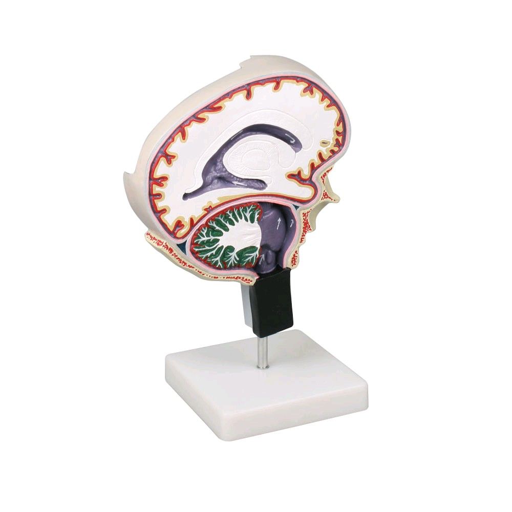 Cerebrospinal fluid circulation model Erler Zimmer, brain slice, color