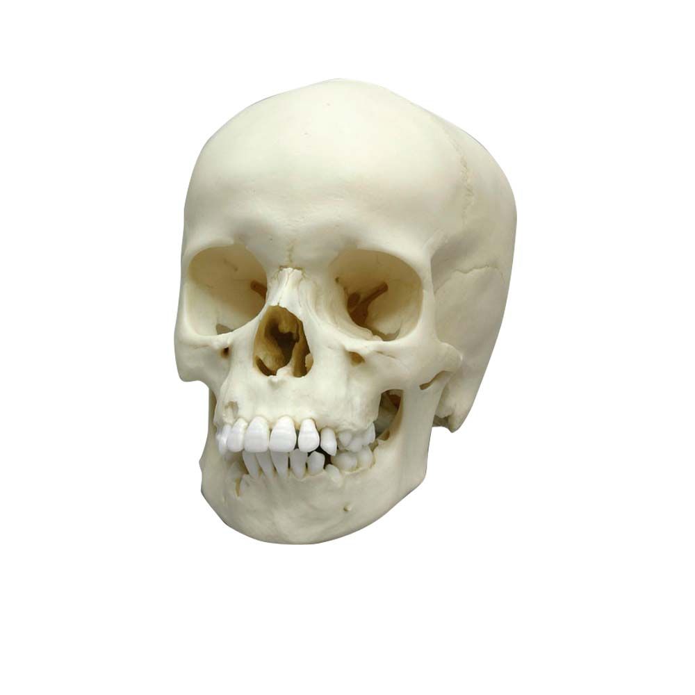 Erler Zimmer Child Skull, 9 Years