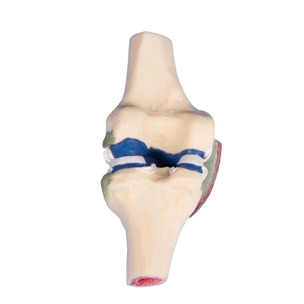 Erler Zimmer joint cutaway model of the knee, colored, life-size