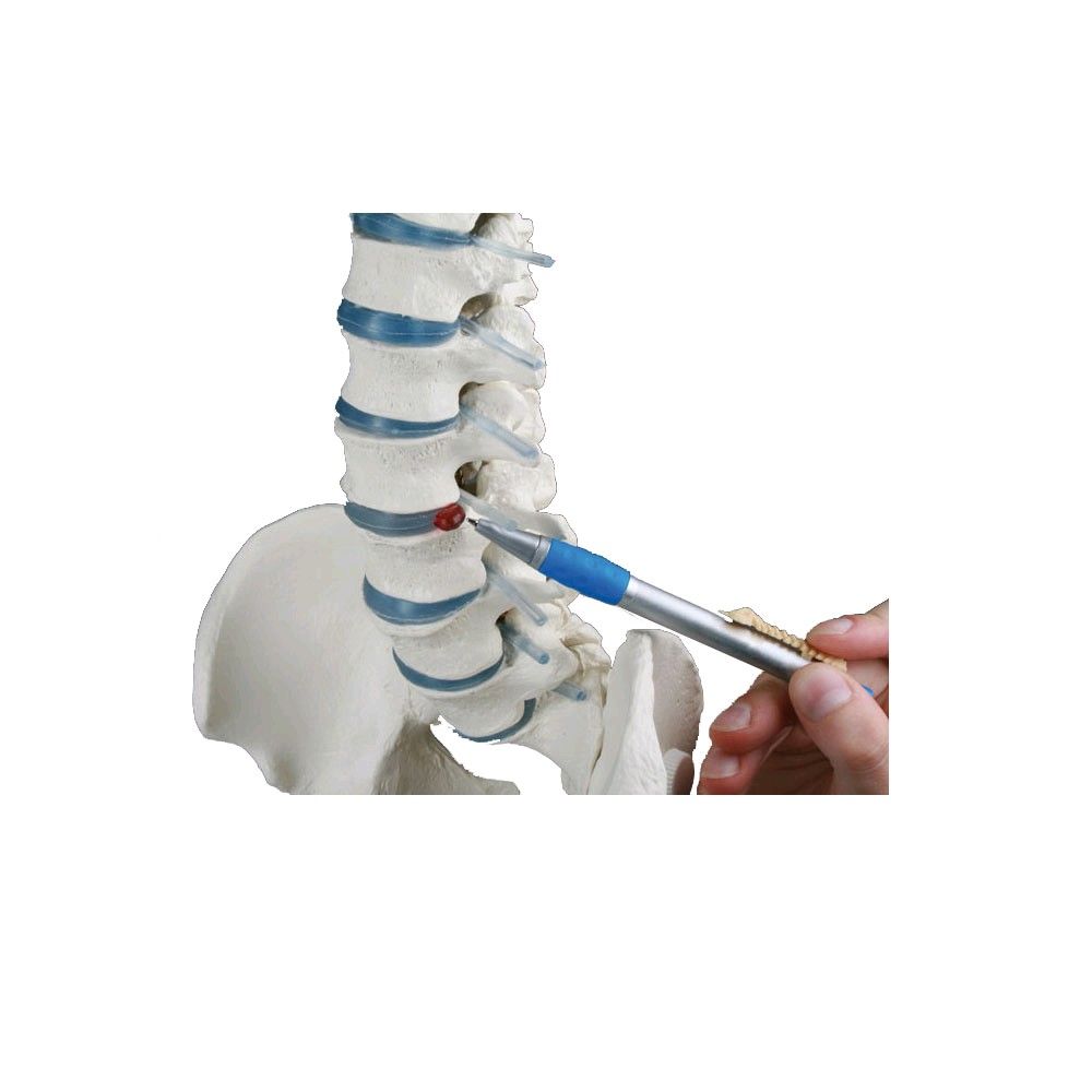 Erler Zimmer spine with disc herniation, pelvis, with tripod