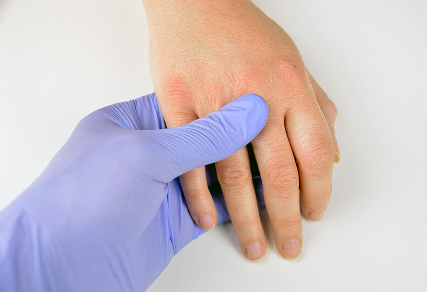 Nitrile gloves in medical examination