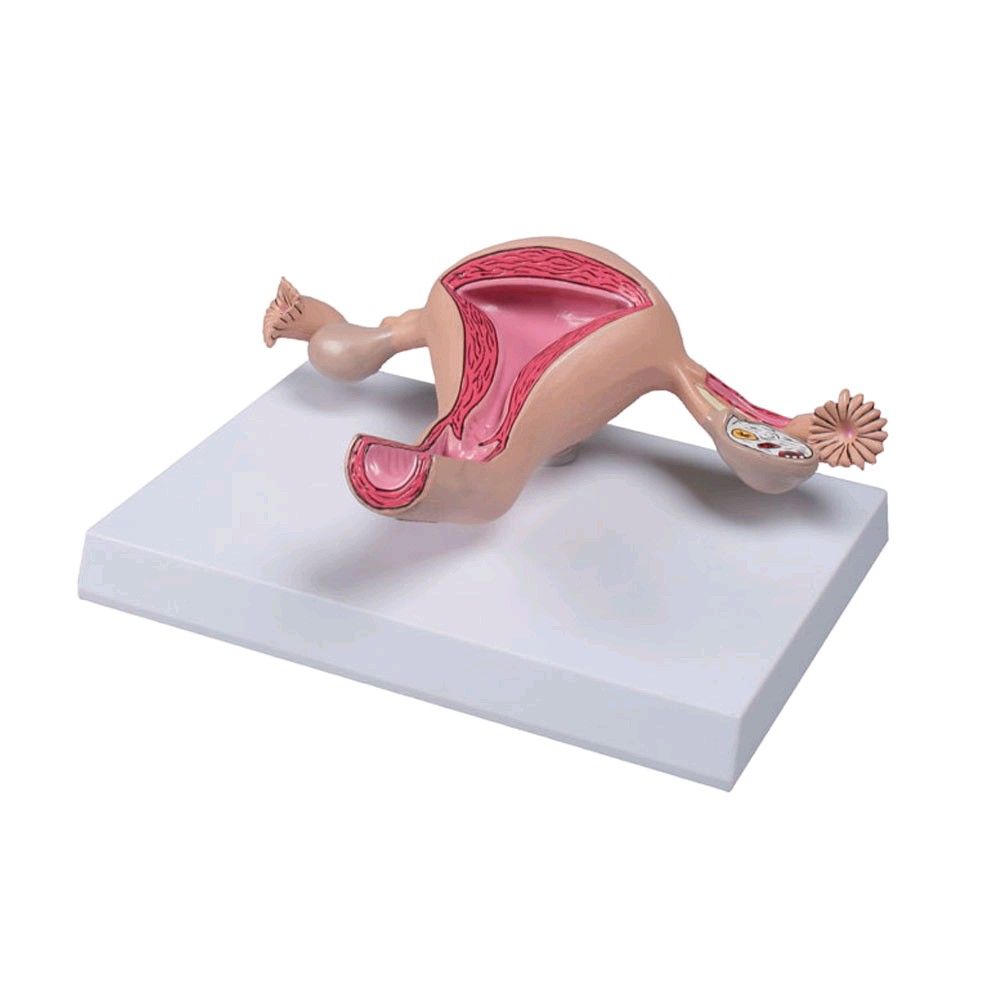 Erler Zimmer uterus model, life-size, painted, teacher card, tripod