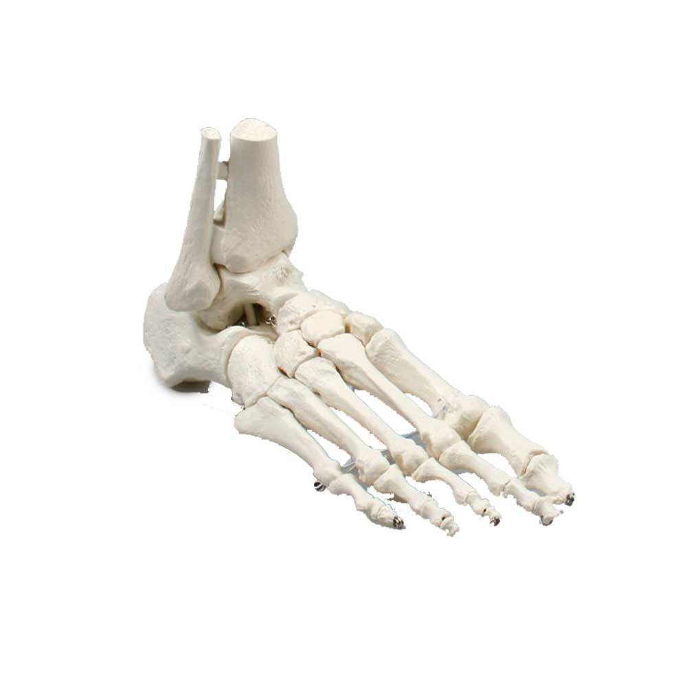 Erler Zimmer Foot Skeleton/Fibula Insertion
