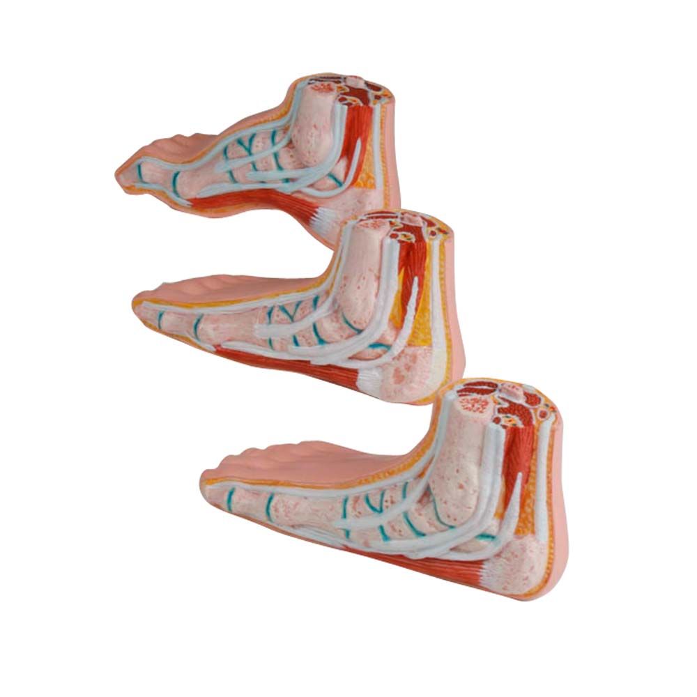 Erler Zimmer Model - Minature Feet, 3 Parts