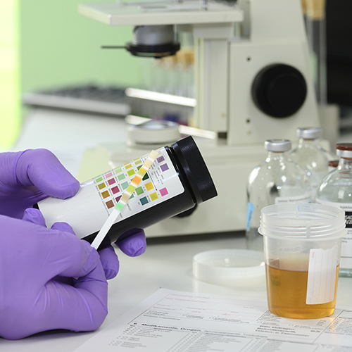 Informative diagnosis with a urinalysis test strip from Medicalcorner24® Interpretation of a urinalysis test strip