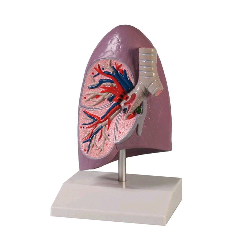 Model of pulmonary half Erler Zimmer, life size, with tripod
