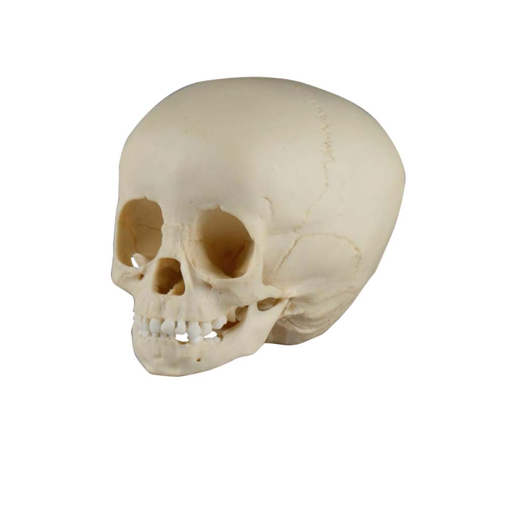 Erler Zimmer Child Skull, One and a Half Year