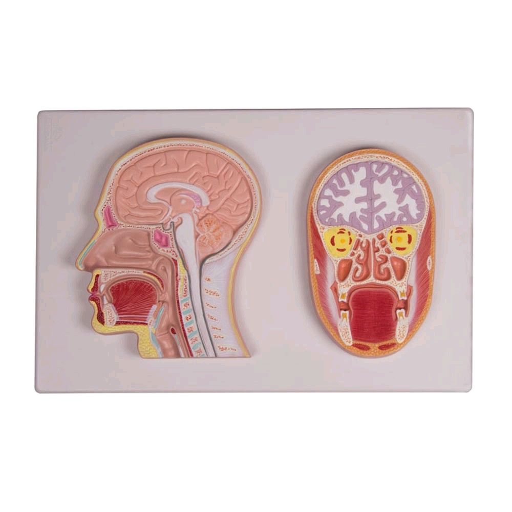 Erler Zimmer relief model, frontal and midline incision from the head