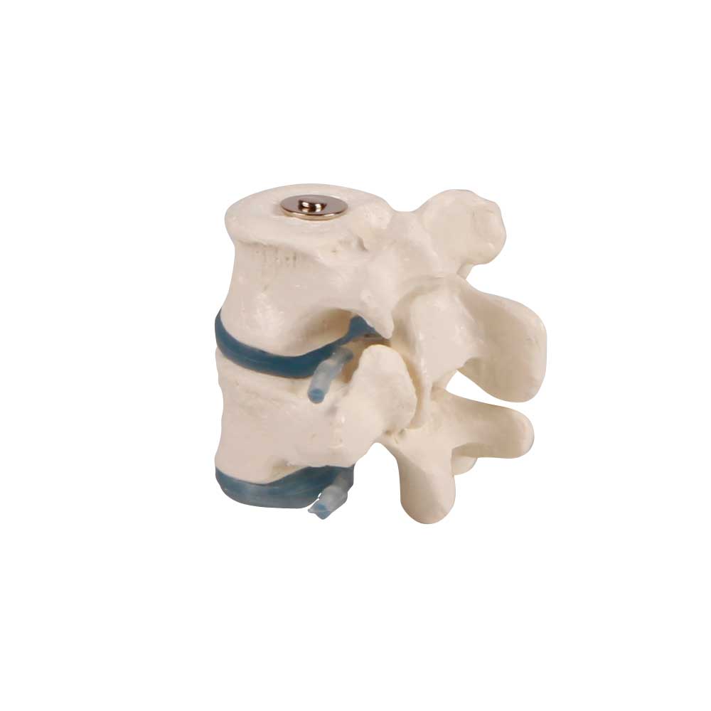 Erler Zimmer Two Lumbar Vertebrae with intervertebral Discs