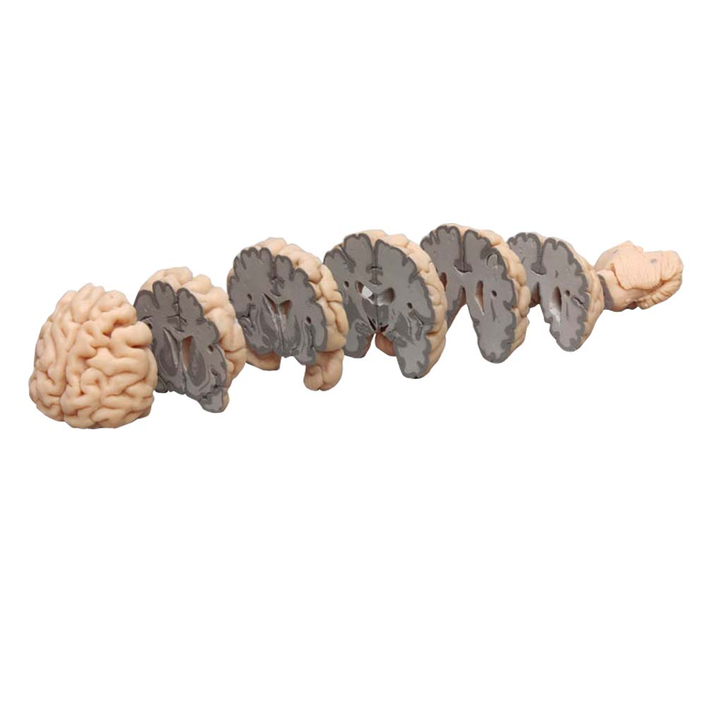 Erler Zimmer Model - Human Brain Multiple Frontal Sections