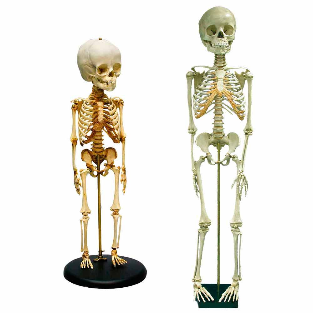 Erler Zimmer Child Skeleton, Different Variants