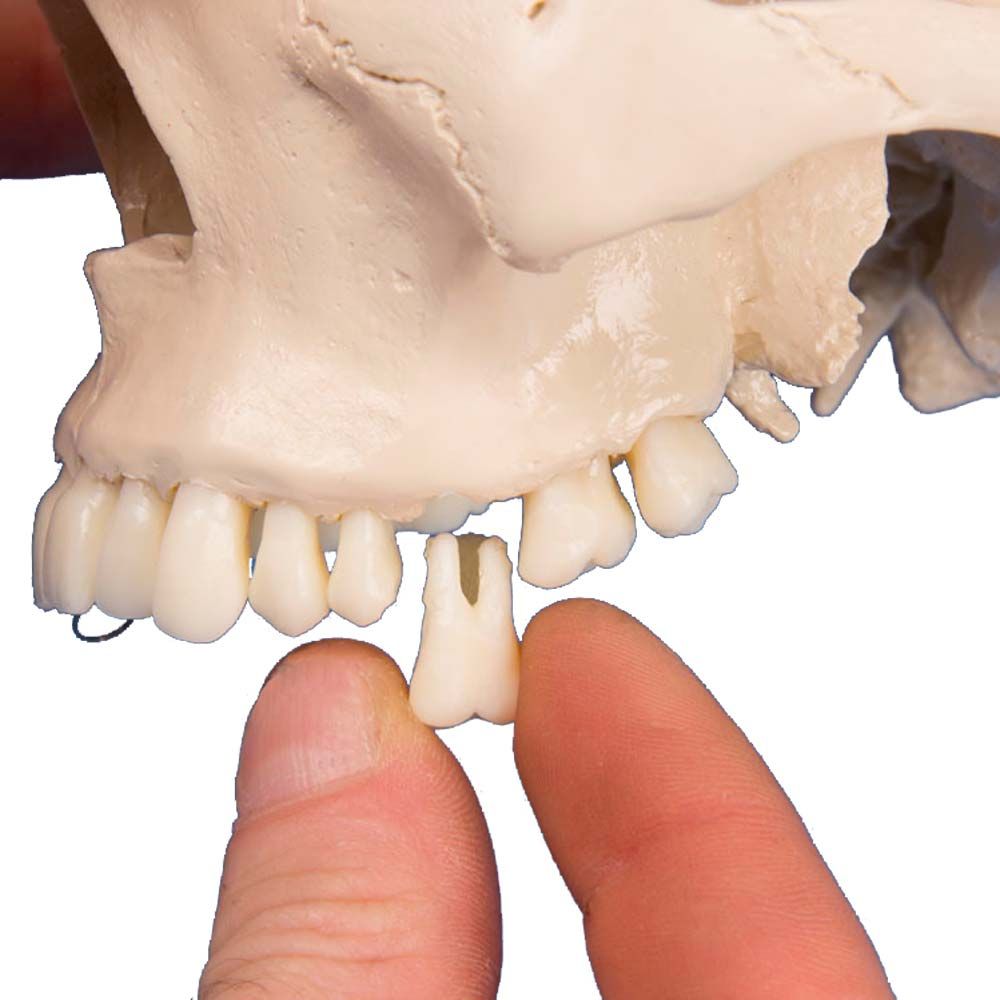 Erler Zimmer Dental Skull Model, 4 parts