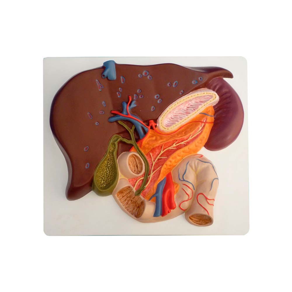Erler Zimmer Model - Liver with Galllbladder, Pancreas and Duodenum