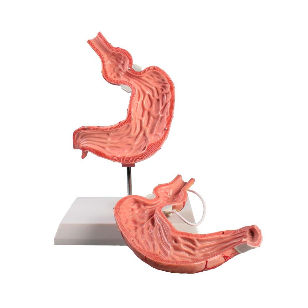 Erler Zimmer Model - Stomach with Gastric Band, on Stand