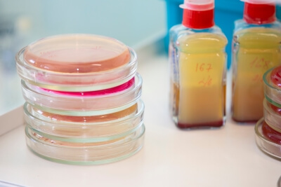Bacterial colonies on a blood agar plate A nutrient medium is used for cultivating microorganisms