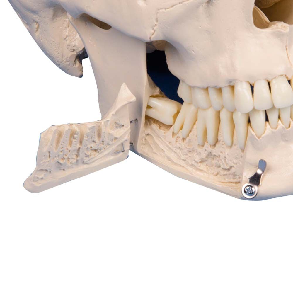 Erler Zimmer Dental Skull Model, 4 parts