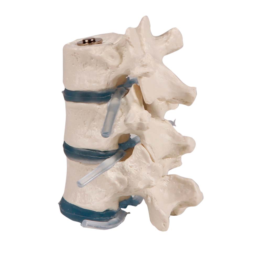 Erler Zimmer Three Thoraric Vertebrae with intervertebral Discs