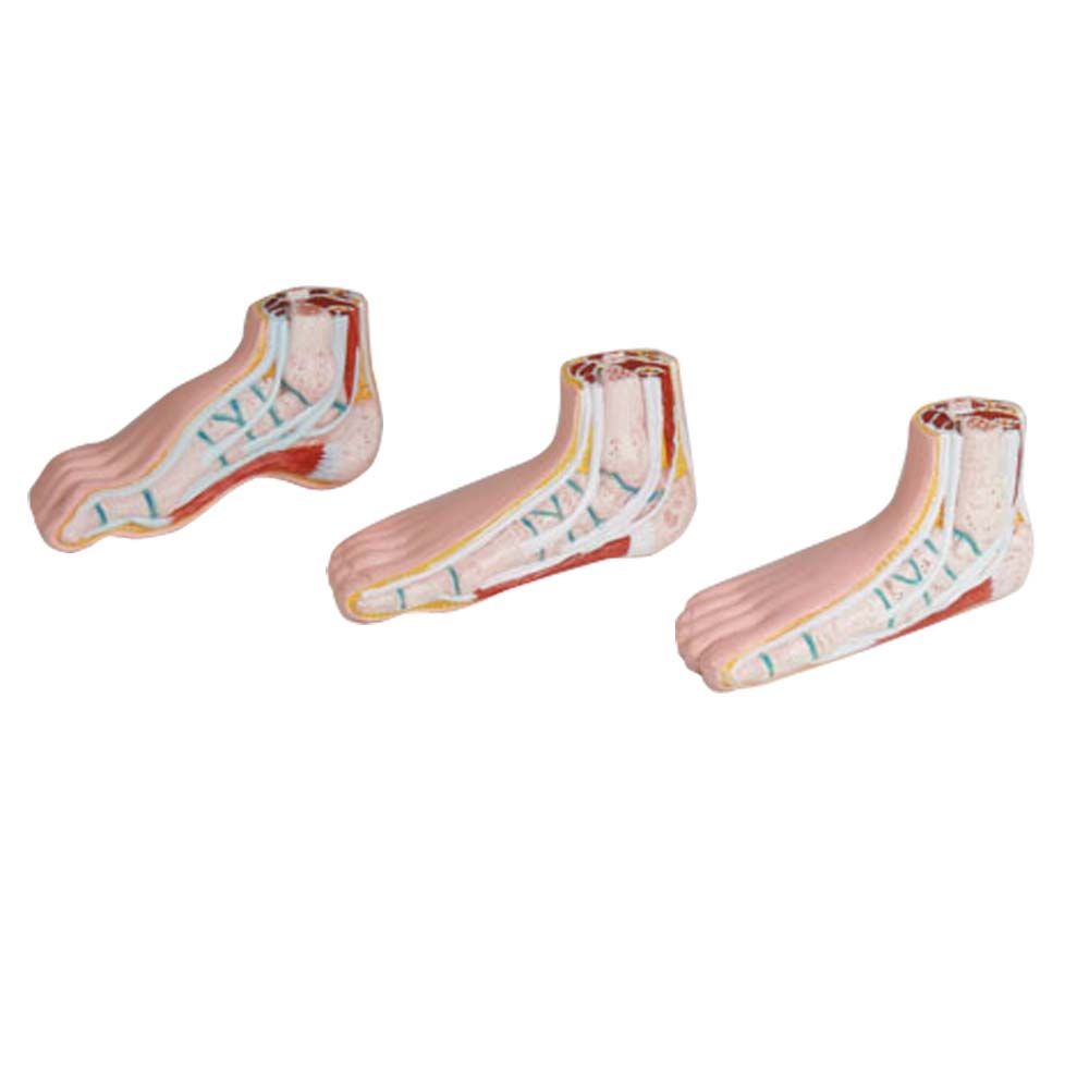 Erler Zimmer Model - Minature Feet, 3 Parts