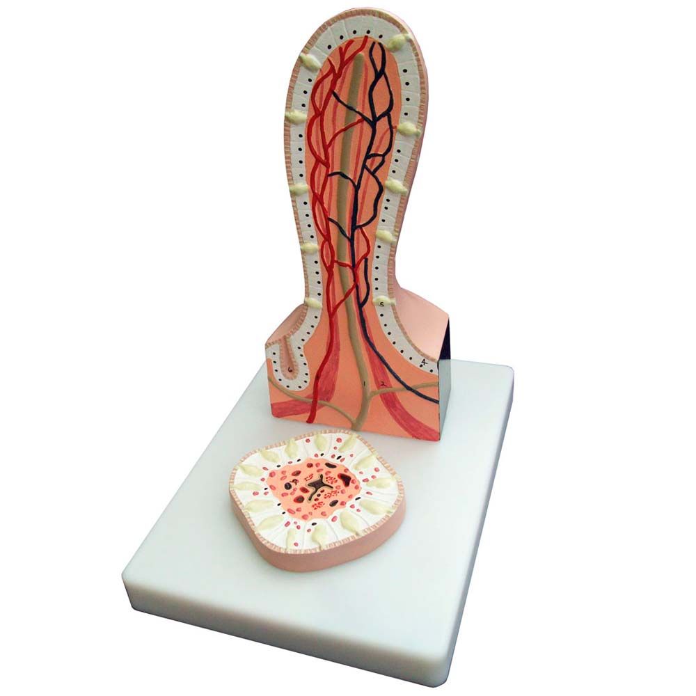 Erler Zimmer Model - Englarged Villus, 2 Parts