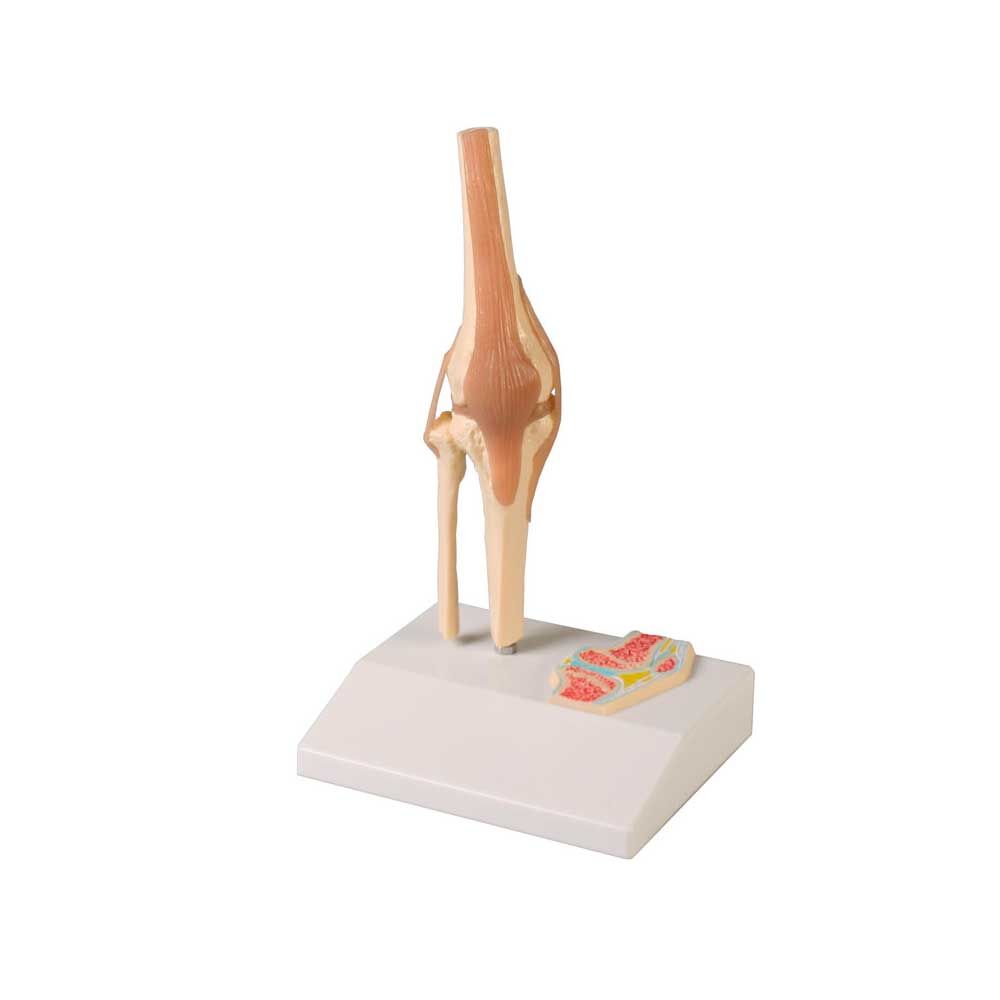 Erler Zimmer Miniature Knee Joint with Cross Section