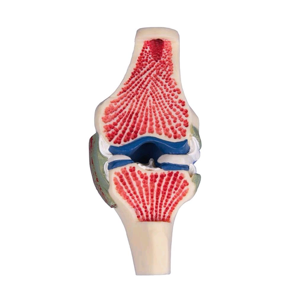 Erler Zimmer joint cutaway model of the knee, colored, life-size