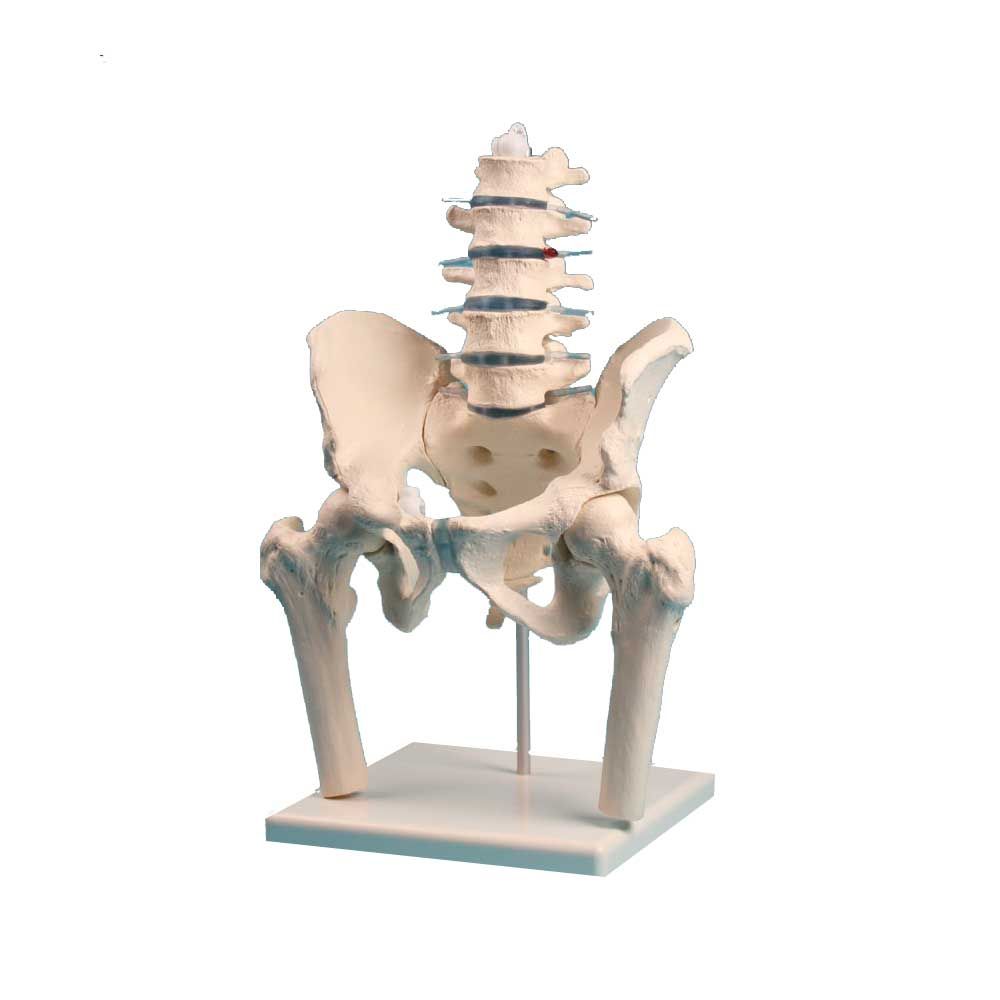 Erler Zimmer Lumbar Spine w. Pelvis and Femoral Stumps, not Movable