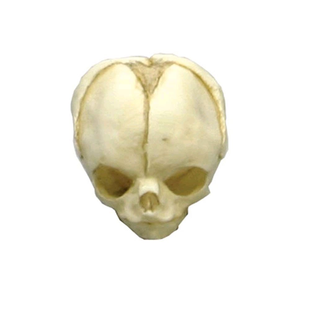 Erler Zimmer fetus skull anatomy model, 20. Development Weeks