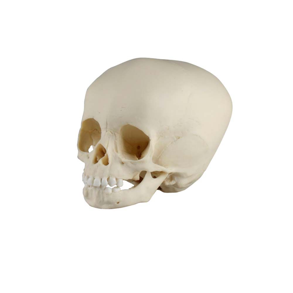 Erler Zimmer Child Skull, 15 Month