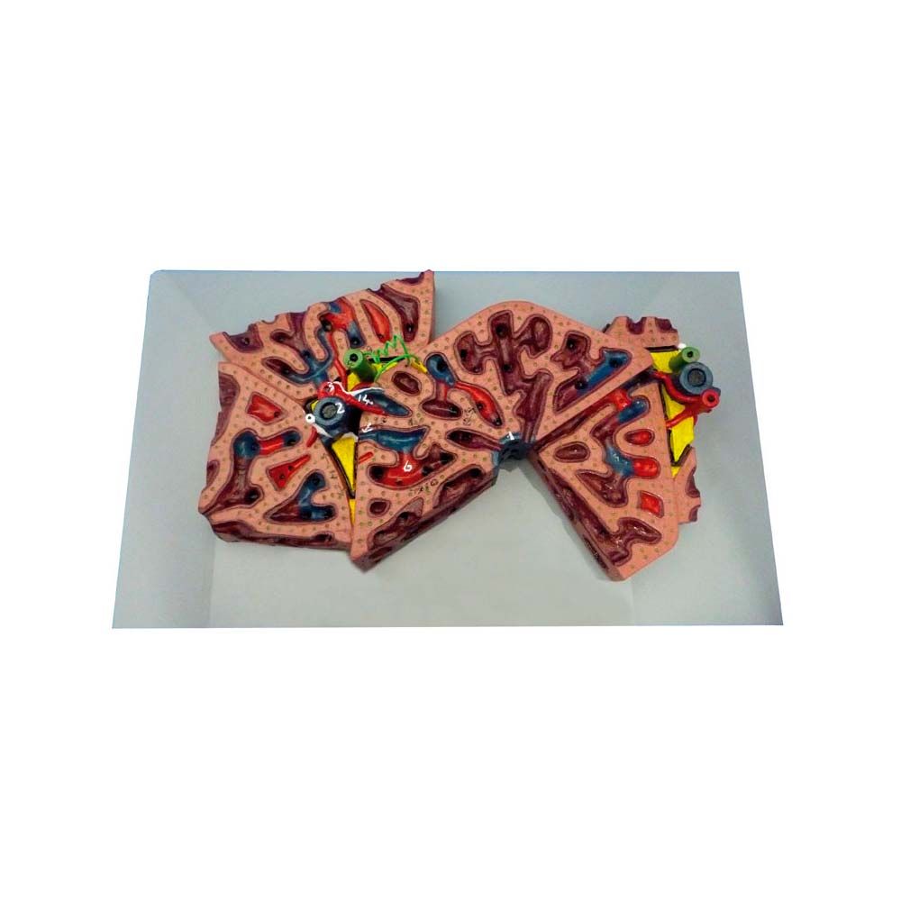 Erler Zimmer Model - Single Liver Lobule, Greatly Enlarged