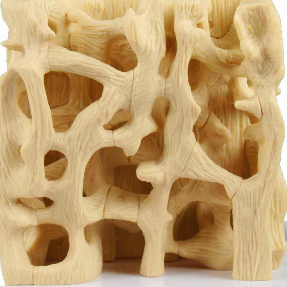Erler Zimmer Comparision Model - Healthy/Osteoporotic Bone Structure