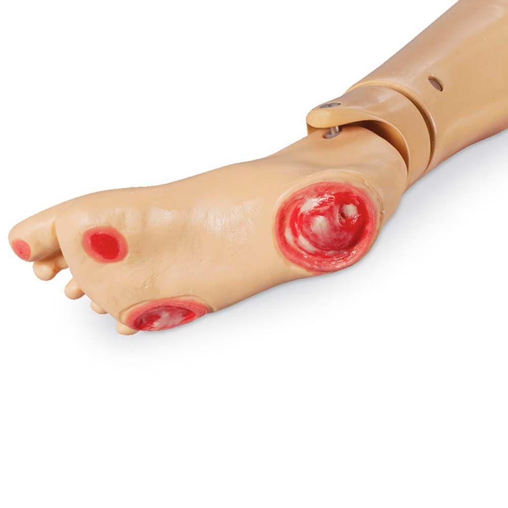 Erler Zimmer Pressure Ulcer Foot for Geri/Keri Doll