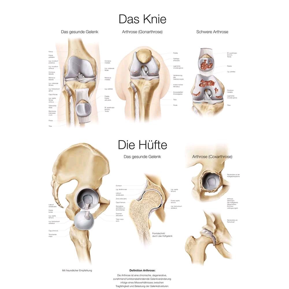 graphic training aid The knee / The hip 50x70cm, Art paper