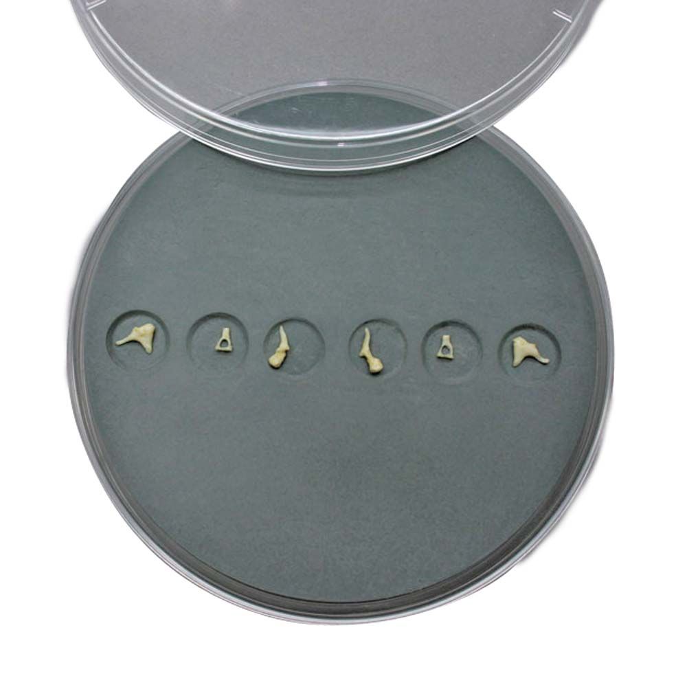 Erler Zimmer Set - Ear Ossicles in Plastic Petri Dish