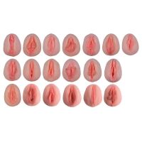 Erler Zimmer Model - Vulva-Casts Showing Anatomical...