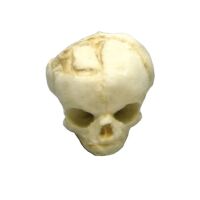 Erler Zimmer fetus skull anatomy model, different. Development Weeks