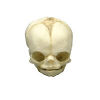 Erler Zimmer fetus skull anatomy model, different. Development Weeks