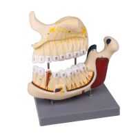 Upper and lower jaw model Erler Zimmer, numbered,...