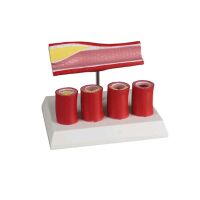 Erler Zimmer artery model, 4 sections, constrictions...