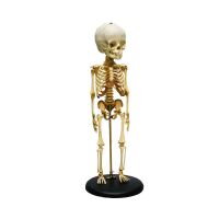 Erler Zimmer Child Skeleton, Different Variants